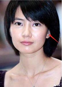 有面部凹陷的明星吗,揭秘独特魅力背后的故事